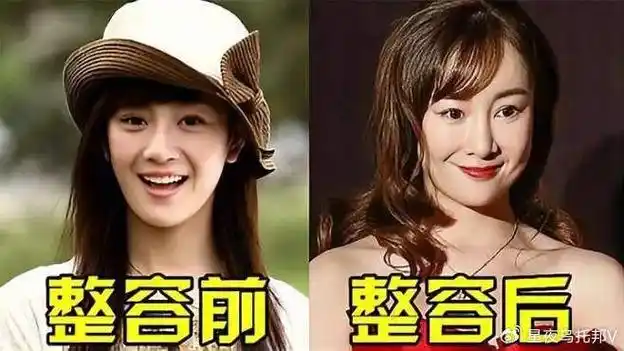 整容堪比毁容,看看张檬的变化,就知道有多吓人了.