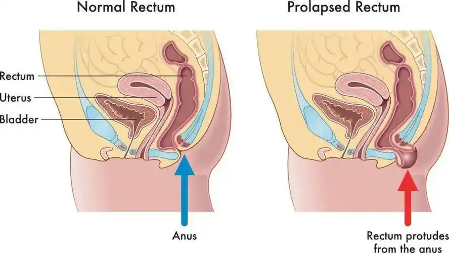 疾病_分泌物_患者