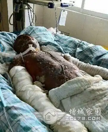 惨不忍睹整个人烧焦了 城丰路爆炸事件后续报道
