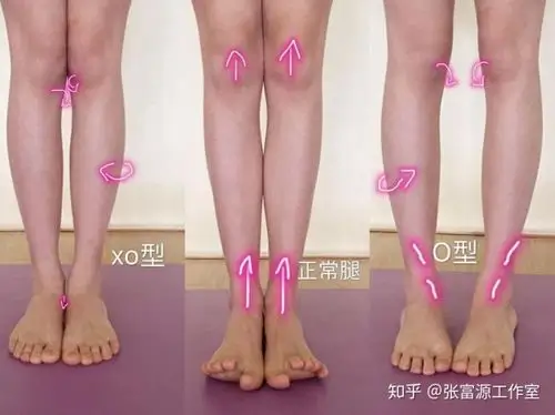 美不美全看腿一分钟腿型自测法