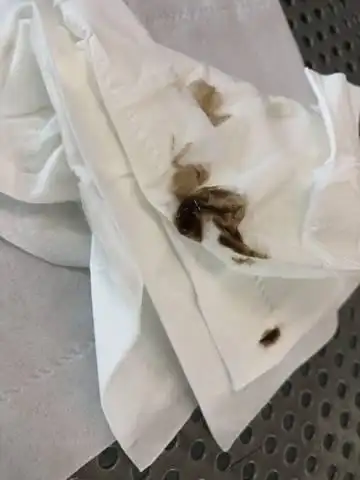 怀孕一个月多点,每次小便都会流出褐色分泌物!谁知道是怎么回事!