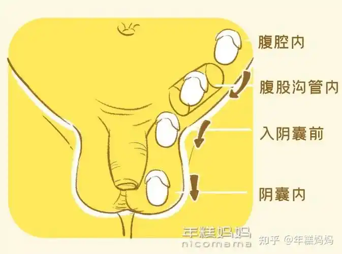 小心耽误孩子!男宝"蛋蛋"出现这几种情况要重视,越早检查越好