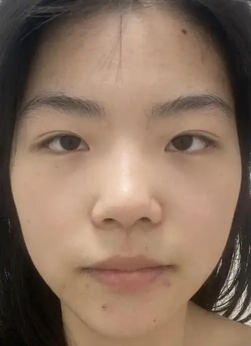 我的原相机正脸照 缺点:双目无神,鼻子塌,眉毛浓,唇周长痘,脸圆,黑