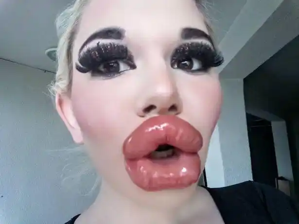 保加利亚美女丰唇20次,自称拥有世界上最大的嘴唇