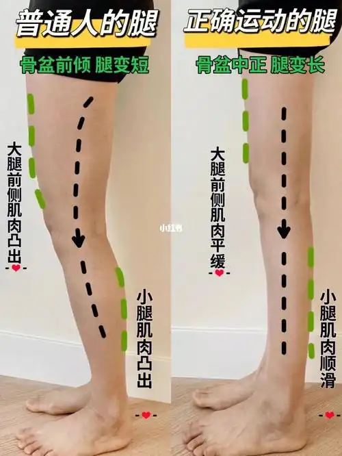 8min矫正小腿外翻拯救小粗腿和小短腿