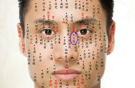 男人脸上的痣图解大全 男人脸上的痣火险是什么意思