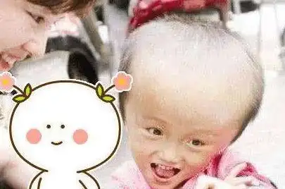 当年喝三鹿奶粉的大头娃娃现在什么样了网友毁了