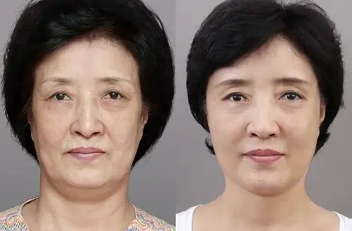 上海华美皮肤松弛怎么紧致——百度百科