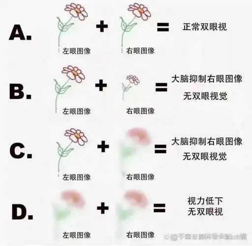 孩子"b","d"不分?经常读写错误有可能不是马虎导致!
