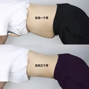 燃烧脂肪膏身体产后肚子腰部皮肤松弛收紧提升霜塑形膏收腹紧致霜