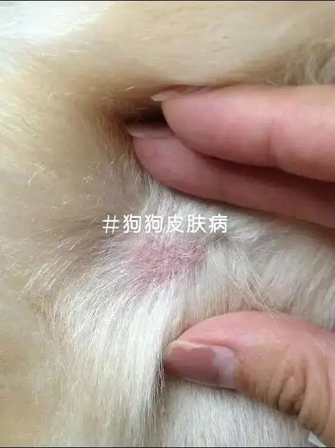 金毛狗癣,后悔没有早点用这个92.9月中旬,由于不明原因,我 - 抖音