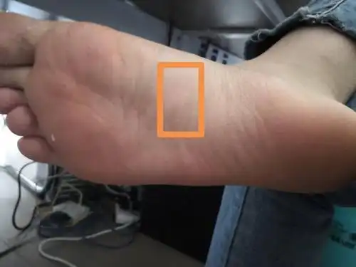 最近脚底中心位置痛是为什么呢?一走路就痛!