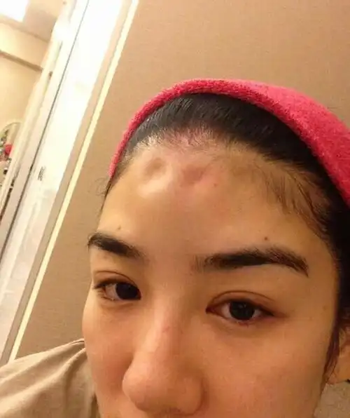 黄奕晒遭家暴照片指责丈夫在自己怀孕期间出轨