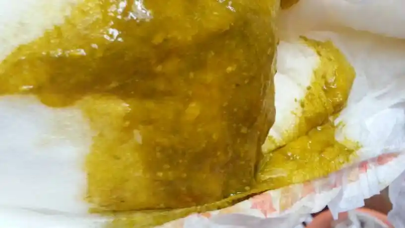 这种情况有可能是消化不良引起的  最好是检查一下大便常规和腹部彩超