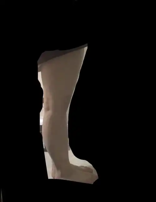 一捏一大坨那种肥肉和肥肉皮(不好形容) 有些时候走路的时候大腿内侧