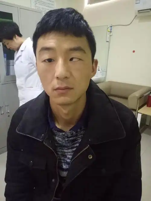 做了斜视手术再也不愁娶不到儿媳妇了