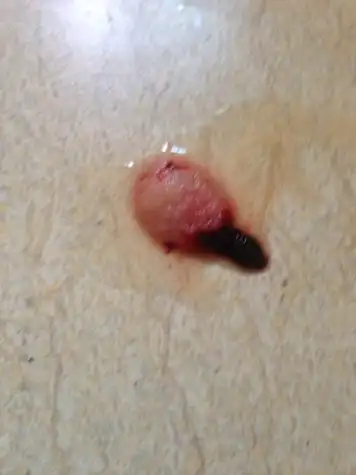 停经49天做的药流,请问这样是孕囊流出来了嘛