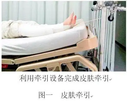 首页 科室导航 专科部 康复医学科 健康教育  一,皮肤牵引:是指将拉力