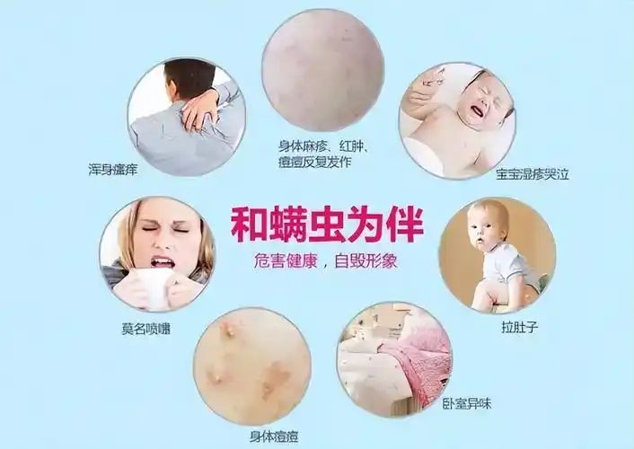 养宠物致眼睑滋生几十只螨虫,螨虫都有哪些危害?如何预防清除?