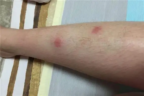 家里跳虫怎么产生的家里有跳虫怎么清理