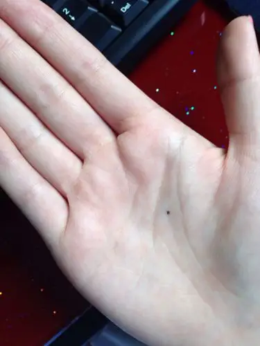 本人女,1987年出生,有谁能帮我看看手相,还有就是我手心的痣是生完我