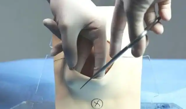 尽管在宫口扩张这一过程就已经开了十指,但在胎儿娩出时,宫口还是会被