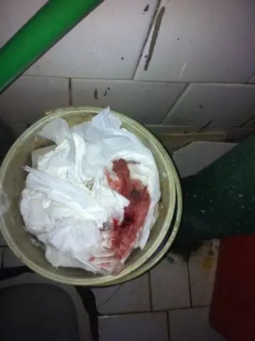 有大姨妈巾吗?看看行吗?