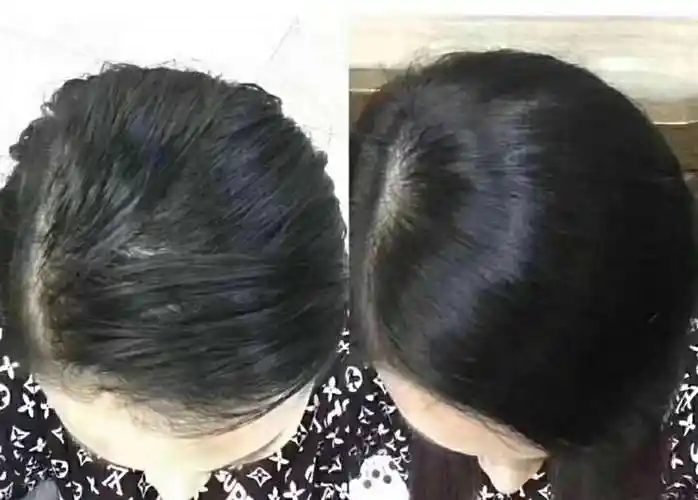 雅菲诗洗护控油效果对比案例!