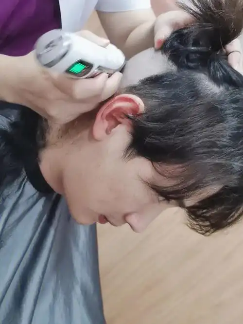 终于忍不住 去植发了