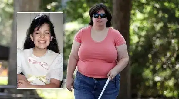 到严重截肢癖(apotemnophilia)他们很清楚地知晓自己想要哪个身体部分