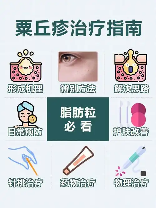 脂肪粒必看粟丘疹治疗指南75建议收藏73
