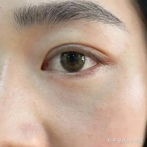 怎么区分眼下干纹和细纹? - 知乎