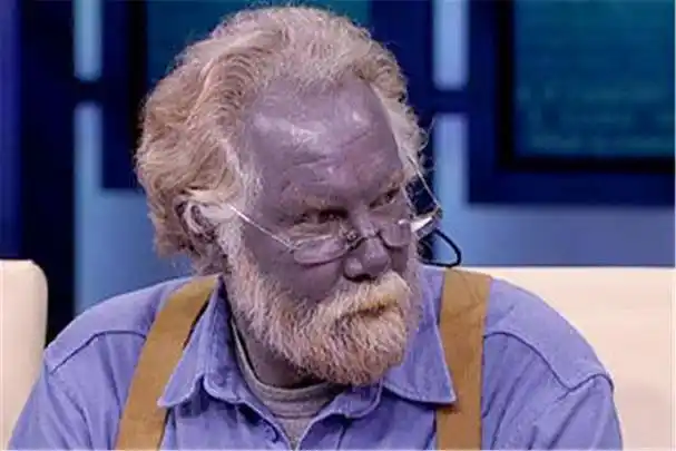 地球上的蓝种人,他在6000米的高山上定居,皮肤血液都是蓝色!