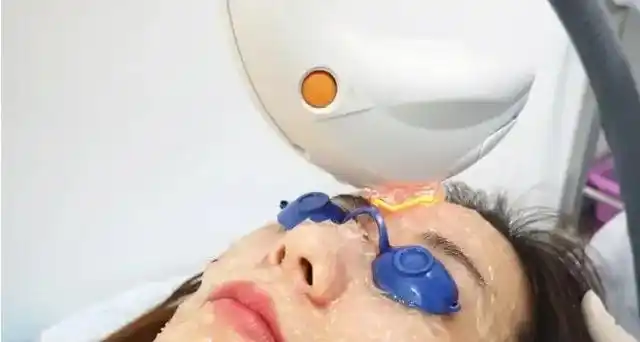 光子嫩肤一次多长时间看出效果效果能持续多久荆州医师来解答