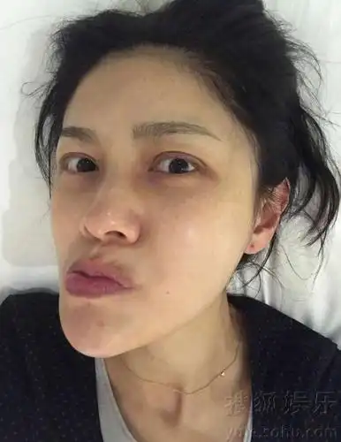 胡可素颜自拍表情搞怪吓死人了色斑黑眼圈明显图