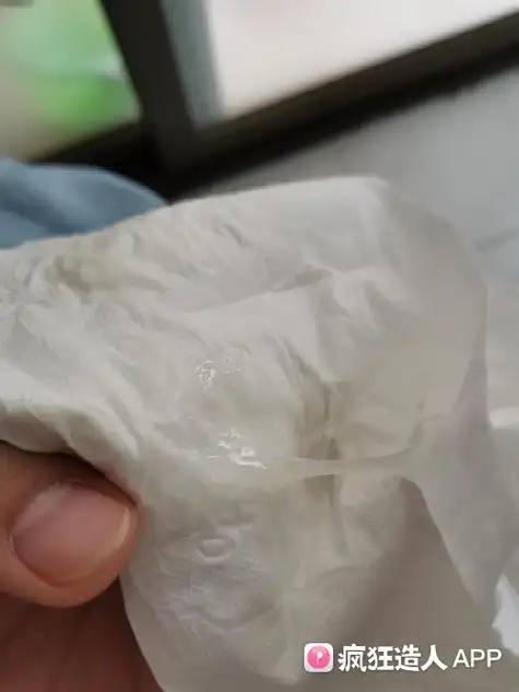 这是排卵期的白带拉丝吗?