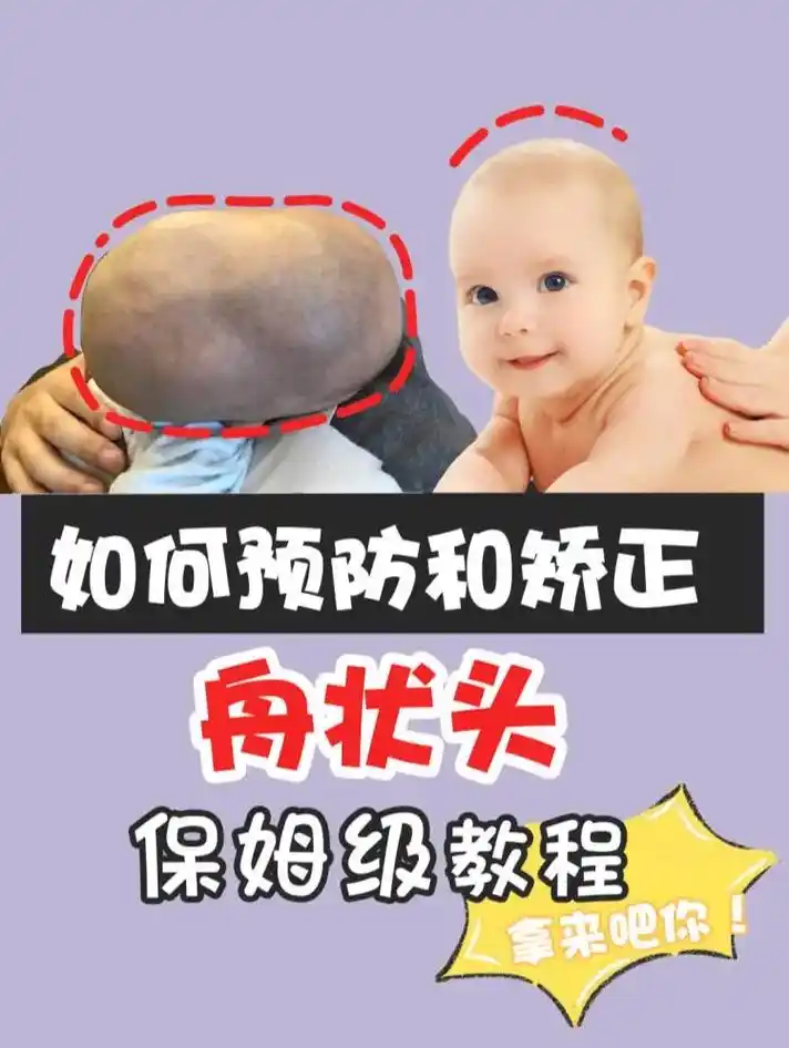 创作灵感 圆头篇|数千位舟状头矫正经验总结7575#宝宝头型  - 抖