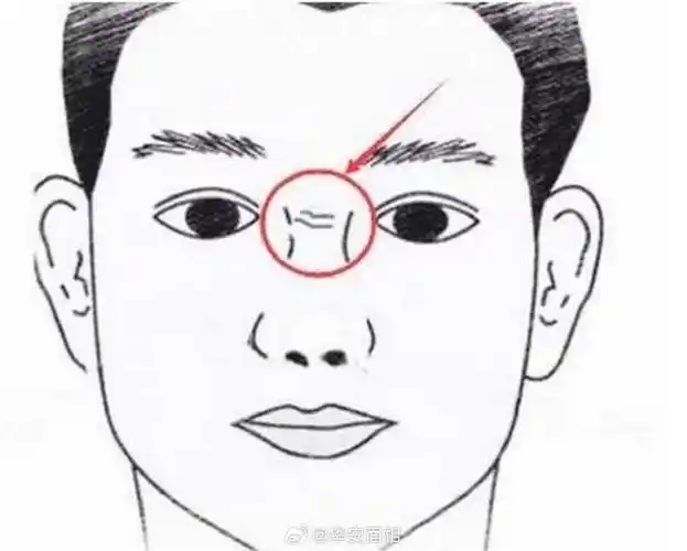 山根有横纹的人,要注意车祸等交通意外,特别是虚岁41