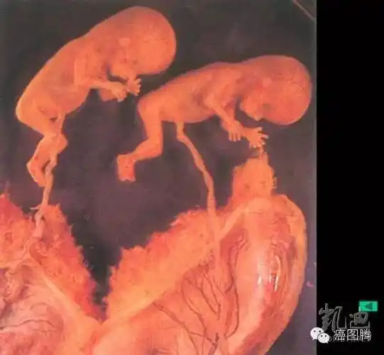 生命现象与癌症揭秘