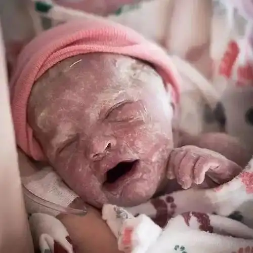 摄影师第二天又拍下了宝宝的照片,就像换了个人似的!惊呼神奇!这