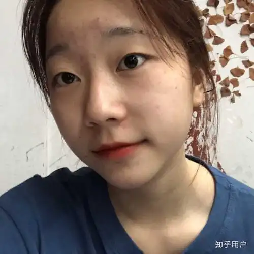 五官每一个都很一般 放图 苹果前置素颜自拍 当时长了好多痘痘!