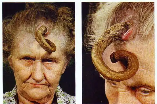 墨西哥9岁女孩产下女婴 让人目瞪口呆的奇人