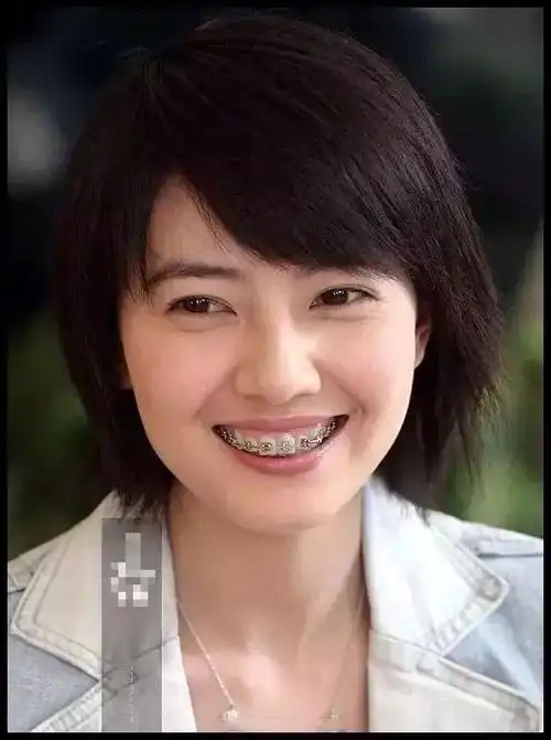 首先,高圆圆的牙齿矫正过,这个事实必须承认.