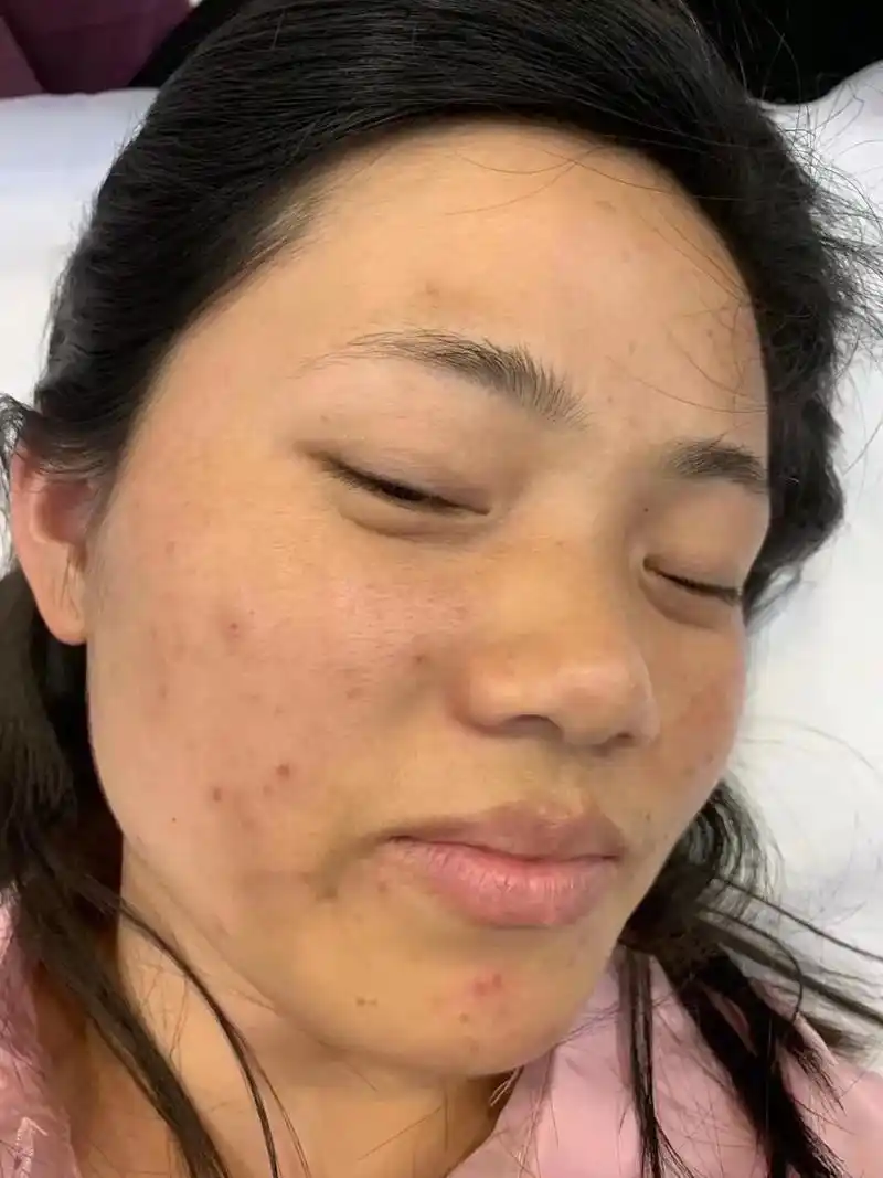 都是中药面膜的客户,皮肤暗黄,天生黑一定要试试这款中药面膜, - 抖音