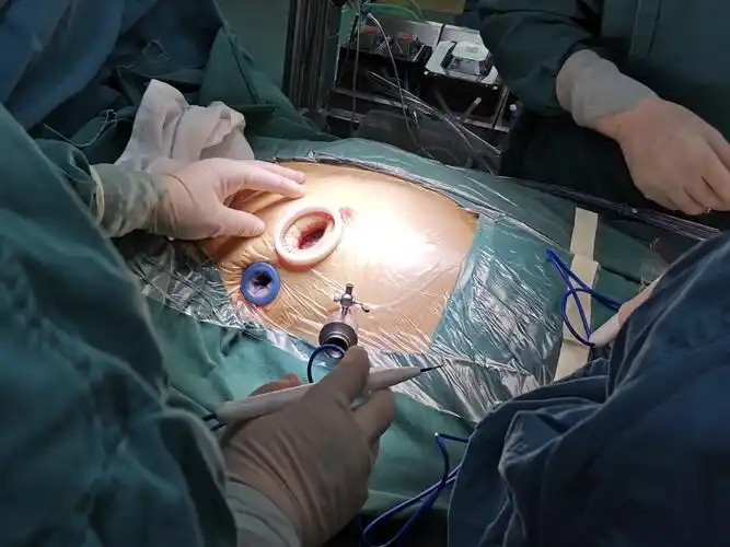 从spacex到微创胸腔镜心脏手术_胸腔镜微创手术_胸腔镜微创手术治疗