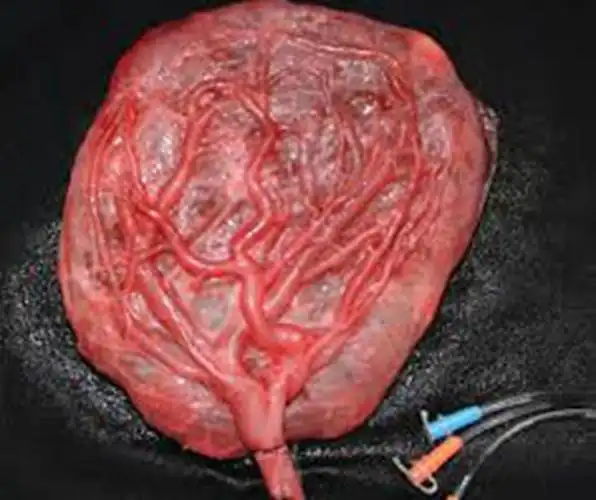 人胎盘详细的特征图片