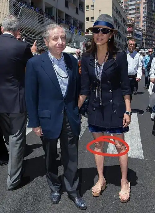 杨紫琼的脚是咋回事,明明全身保养的像女神,但脚却畸形到吓人