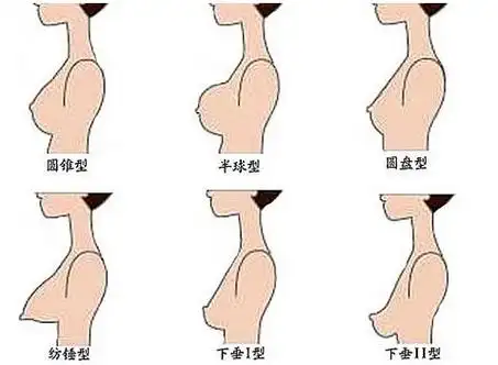 孕妇梦见乳房下垂 乳房下垂干瘪皱巴巴-神算网