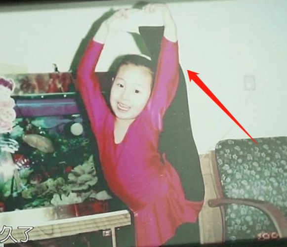 有种"超常发育"叫郑爽,见到童年修复照下的细腿,柠檬酸了