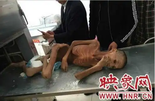 信阳救助站儿童死亡事件